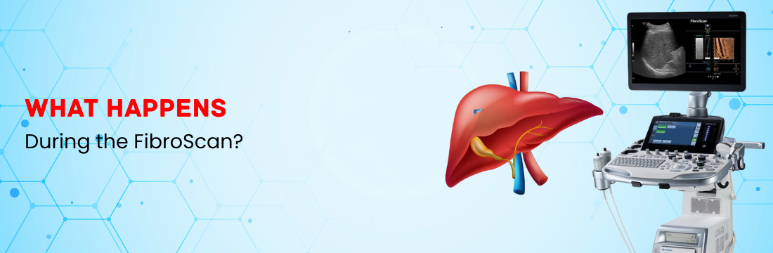 What Happens in the FibroScan?